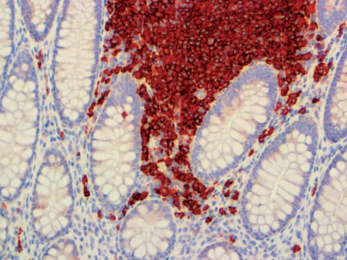 IHC of CD19 on an FFPE Colon Tissue